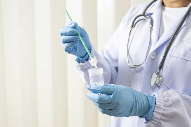 Ginecologa tiene in mano un bastoncino con estremità in cotone per effettuare il Pap test