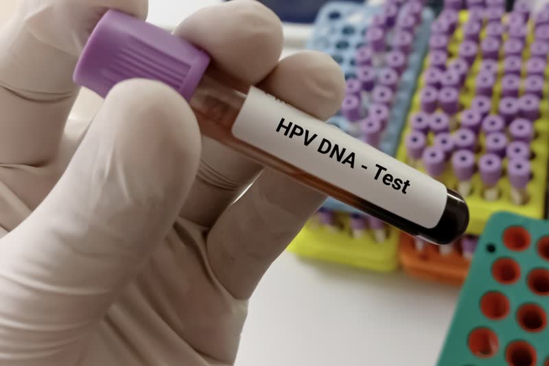 Medico specialista con in mano una provetta con un campione di sangue e sullo sfondo un blister di altri campioni pronti per essere sottoposti a HPV test