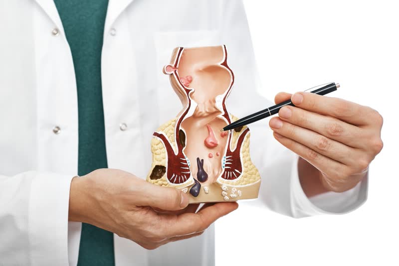 Foto di dottore in camicie bianco con in mano una miniatura di un apparato digerente mentre indica con una penna l'intestino per rappresentare la colonscopia
