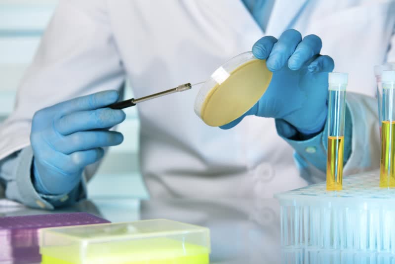 Foto di dottore in camice bianco con guanti di plastica azzurri mentre con una mano tiene un vetrino con un campione di urina per effettuare un esame colturale delle urine (urinocoltura)