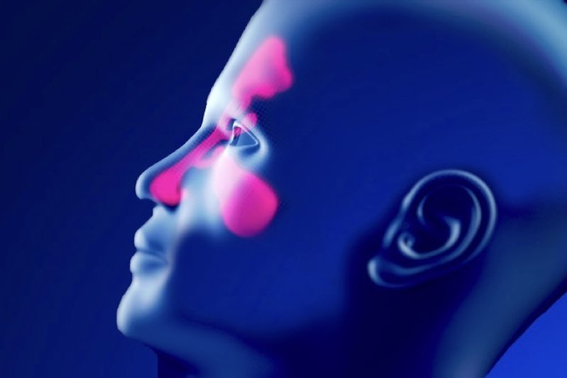 Illustrazione 3d del naso e viso di un uomo per descrivere la sinusite
