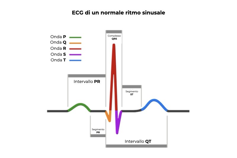 Illustrazione di un ECG di un ritmo cardiaco normale