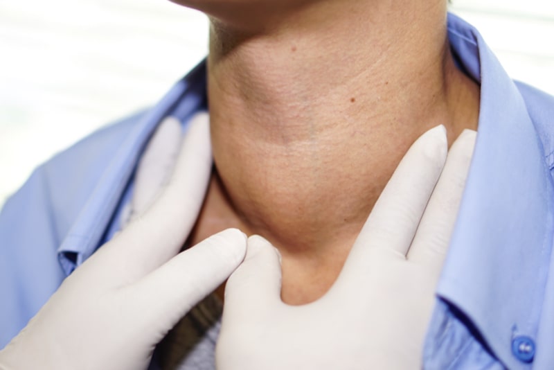 Medico che pratica palpazione alla gola ingrossata di una donna che soffre di ipertiroidismo