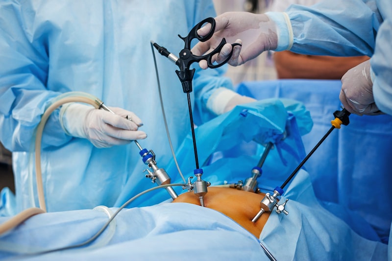 Primo piano di un intervento di laparoscopia ginecologica