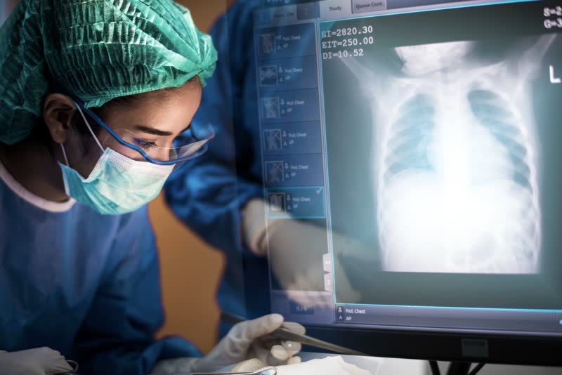 Medico chirurgo pneumologo concentrata in sala operatoria con sullo sfondo un'immagine a raggix dei polmoni di un paziente durante un intervento di trapianto di polmoni