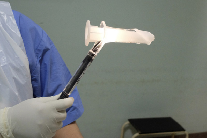  Medico che tiene in mano il Proctoscopio per l'esame dell'ano e del retto