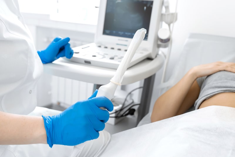 Primo piano della sonda a ultrasuoni usata da una ginecologa su una paziente sdraiata sul lettino per eseguire un'ecografia vaginale