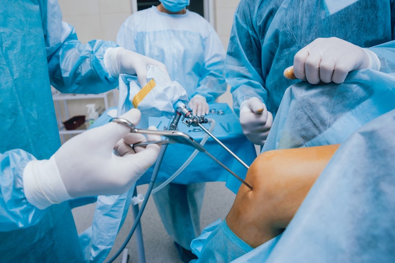 Primo piano della gamba di un paziente mentre il chirurgo inserisce l'artroscopio. Sullo sfondo la sala operatoria e l'equipe medica