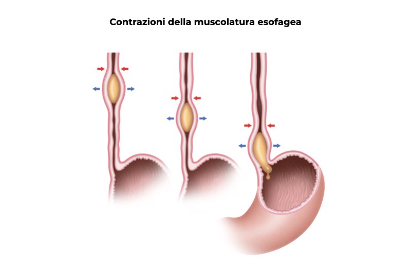 Illustrazione di un esofago per descrivere come avvengono le contrazioni della muscolatura esofagea