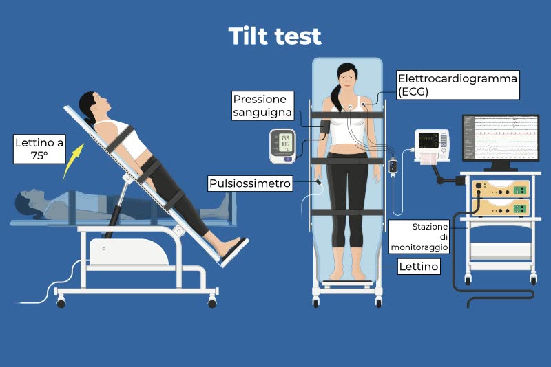 Illustrazione di un tilt test con paziente posizionato su un lettino a 75° e le varie strumentazioni necessarie per il corretto svolgimento dell'esame