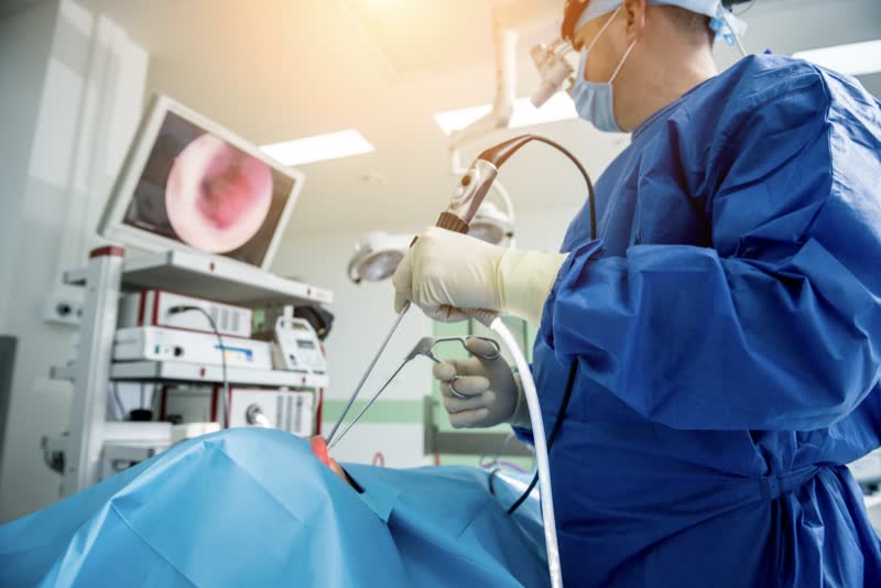 Foto di dottore in camice blu mentre svolge un esame endoscopico (endoscopia) inserendo un endoscopio nel del tratto digerente di un paziente disteso su un lettino di un ospedale. In secondo piano uno schermo che mostra le immagini dell'endoscopia