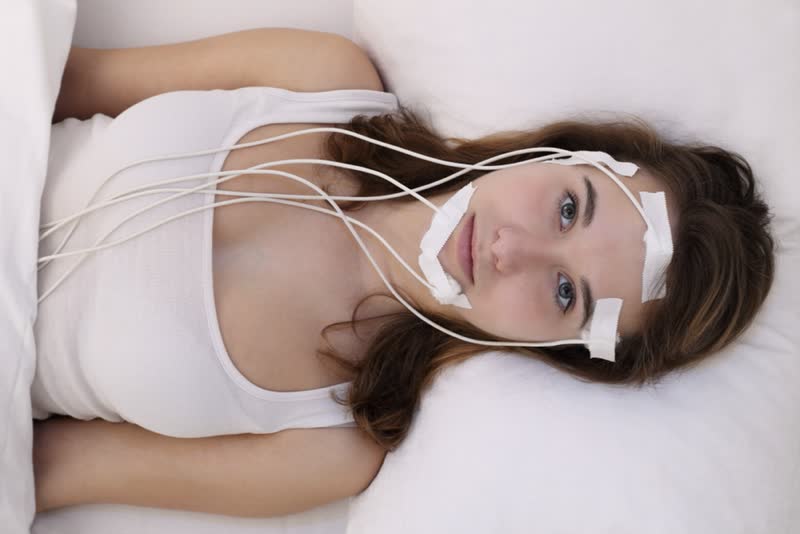 Foto di donna con il volto coperto da elettrodi necessari per effettuare una polisonnografia per monitorare il sonno