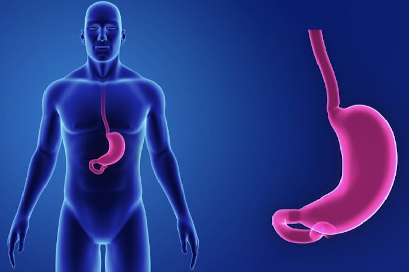 Illustrazione 3d di uno stomaco per descrivere la malattia da reflusso gastroesofageo