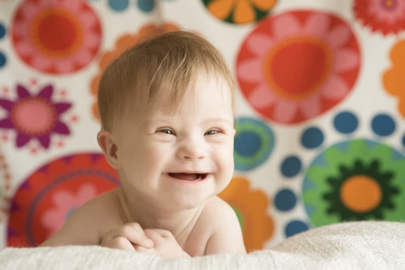 Bambino piccolo che sorride sopra un letto in una stanza con dei giori disegnati sulla parete affetto da sindrome di down