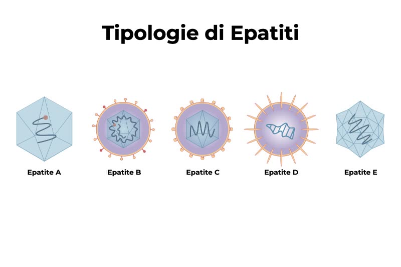 Varie tipologie di di virus dell'epatite. A  B, C, D ed E