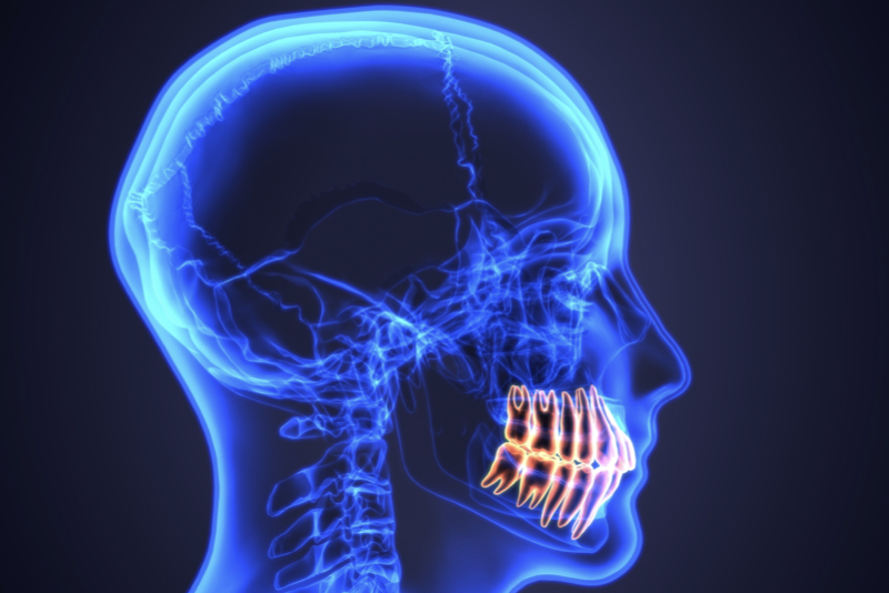 Illustrazione 3D di cranio con in evidenza l'arco dentale per rappresentare il bruxismo