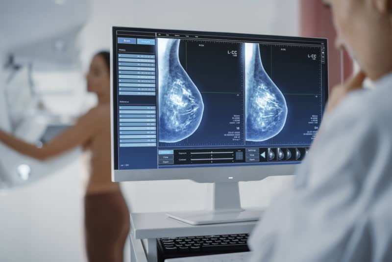 Esempio di mammografia