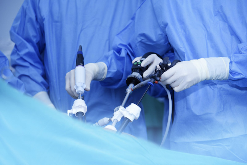 Primo piano delle mani di due chirurghi con in mano gli strumenti per svolgere un intervento in laparoscopia attraverso la cavità addominale