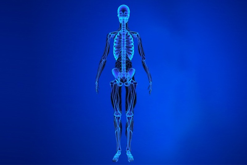 Illustrazione 3d dello scheletro umano per descrivere la protesi dell'anca