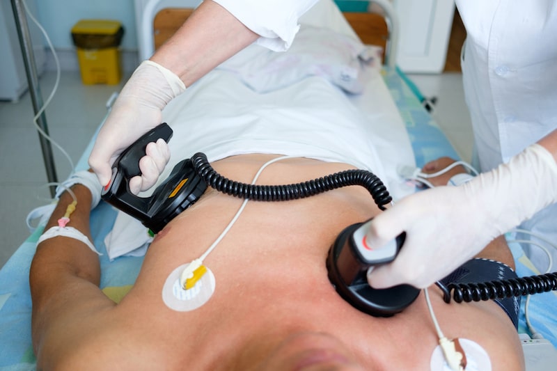 Primo piano del petto di un paziente sdraiato su un lettino di un ospedale mentre un medico applica gli elettrodi  per eseguire la cardioversione elettrica 