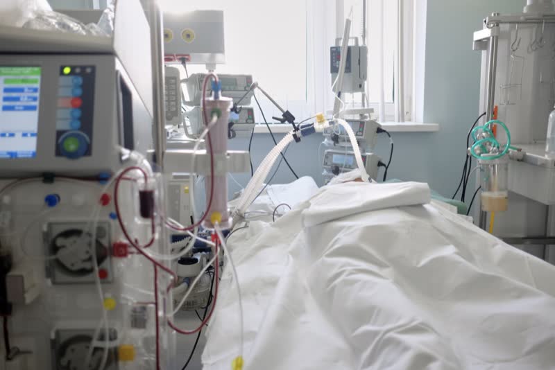 Immagine di una camera ospedaliera con macchinario per l'emofiltrazione sulla sinistra, tubi e cavi in tutto l'ambiente e con al centro un paziente sdraiato con le coperte che gli coprono il viso che sta ricevendo il trattamento
