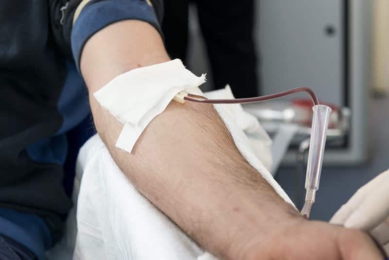 Braccio di paziente con ago inserito in vena per una seduta di emofiltrazione (trasfusione di sangue)