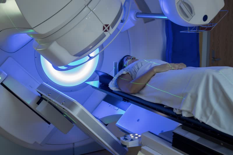Donna stesa sul lettino di un macchinario medico di radioterapia mentre viene trattata per un cancro al seno tramite radioterapia